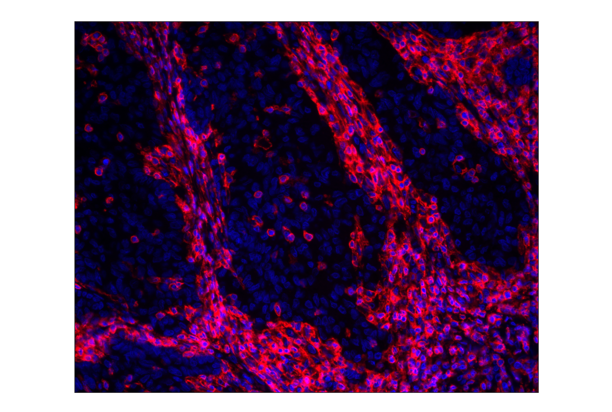 Alexa Fluor 647 標識抗体 | Cell Signaling Technology
