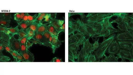 Immunofluorescent analysis of NTERA-2 and HeLa cells.